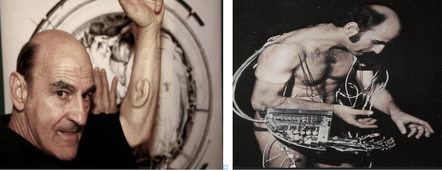 عمل Stelarc في ’الرجل الإلكتروني cyborg’، وعمل ’الأذن الثالثة كما هو في الصورة’. الشكل 12.